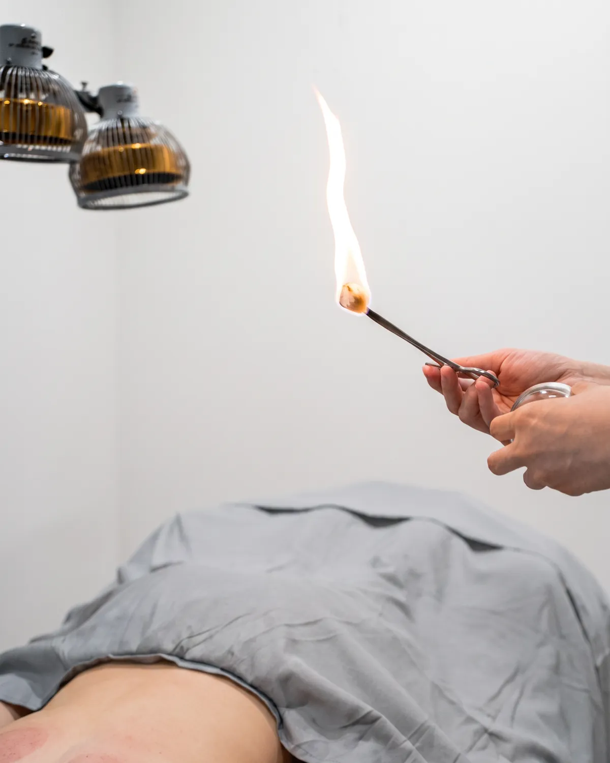 Moxibustion in progress at Fittopia Wellness Studio, with a patient draped on the treatment table below.